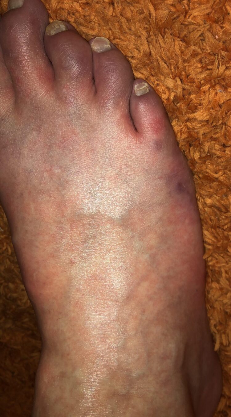 tobe keen feet 4 scaled