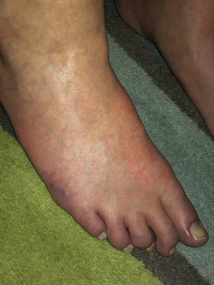 tobe keen feet 6 scaled