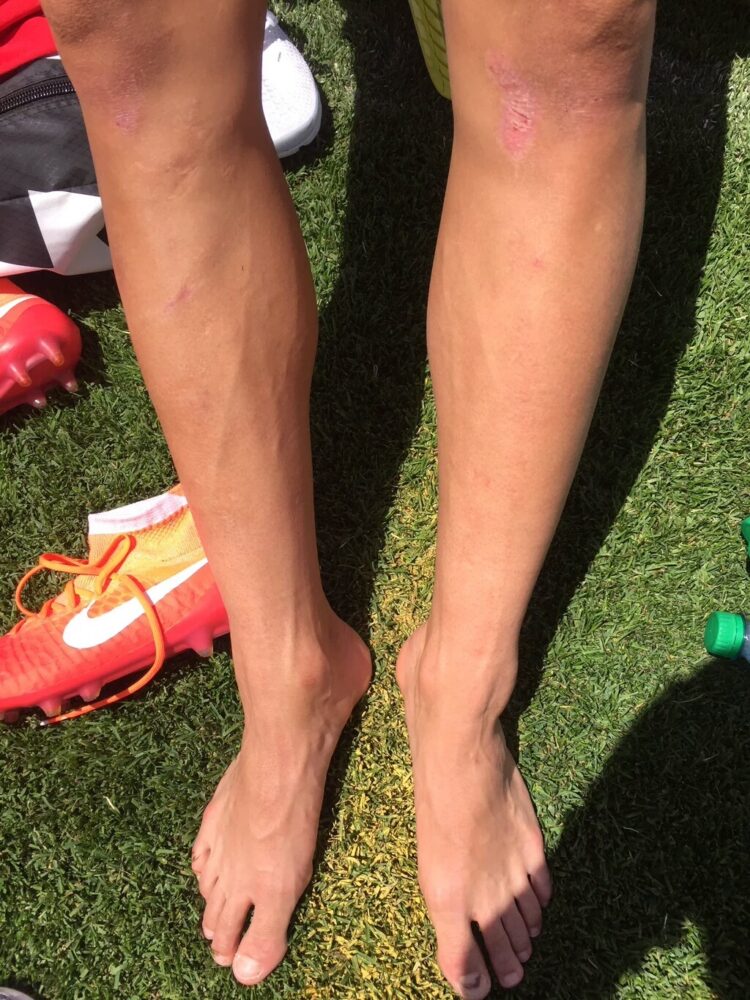 tobin heath feet