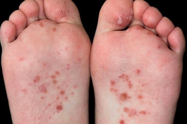 too much mouth feet 2