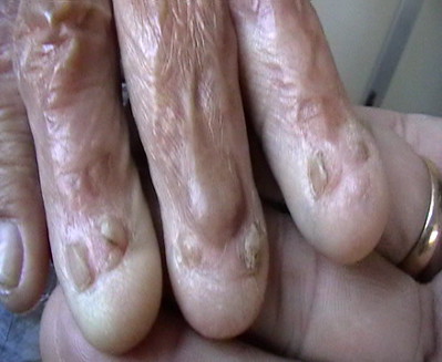 tran thi nhung feet 3