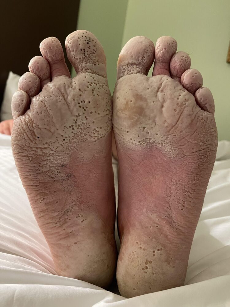 tree ma feet 2 scaled