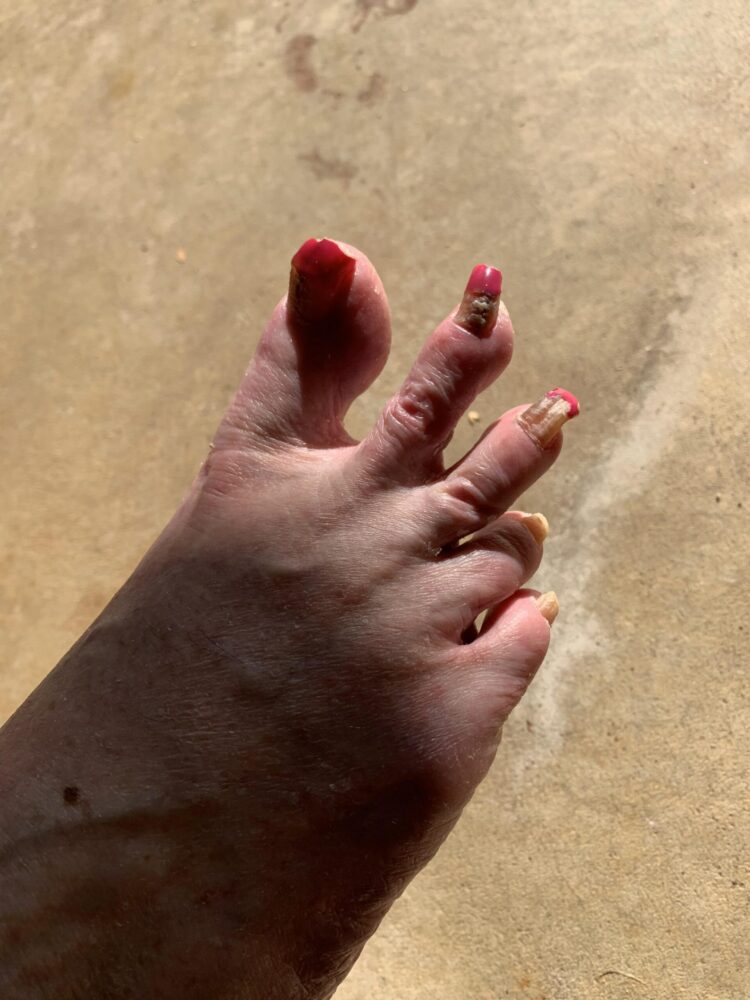 trendyxgrandma feet 3 scaled