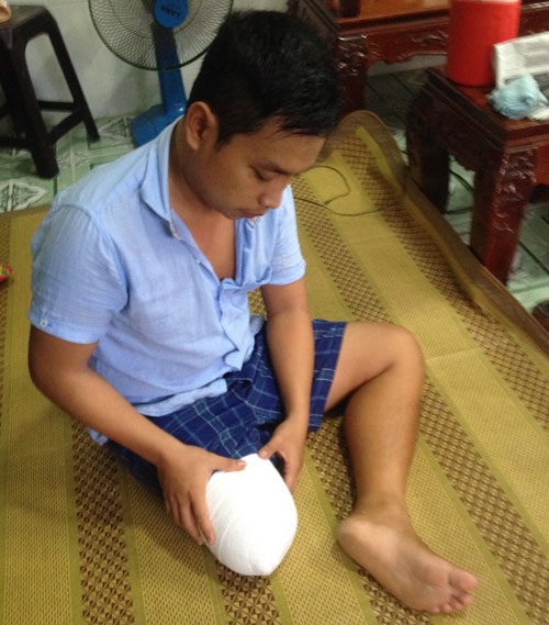 truong vu hoang lam feet