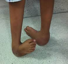 uche nwosu feet 4