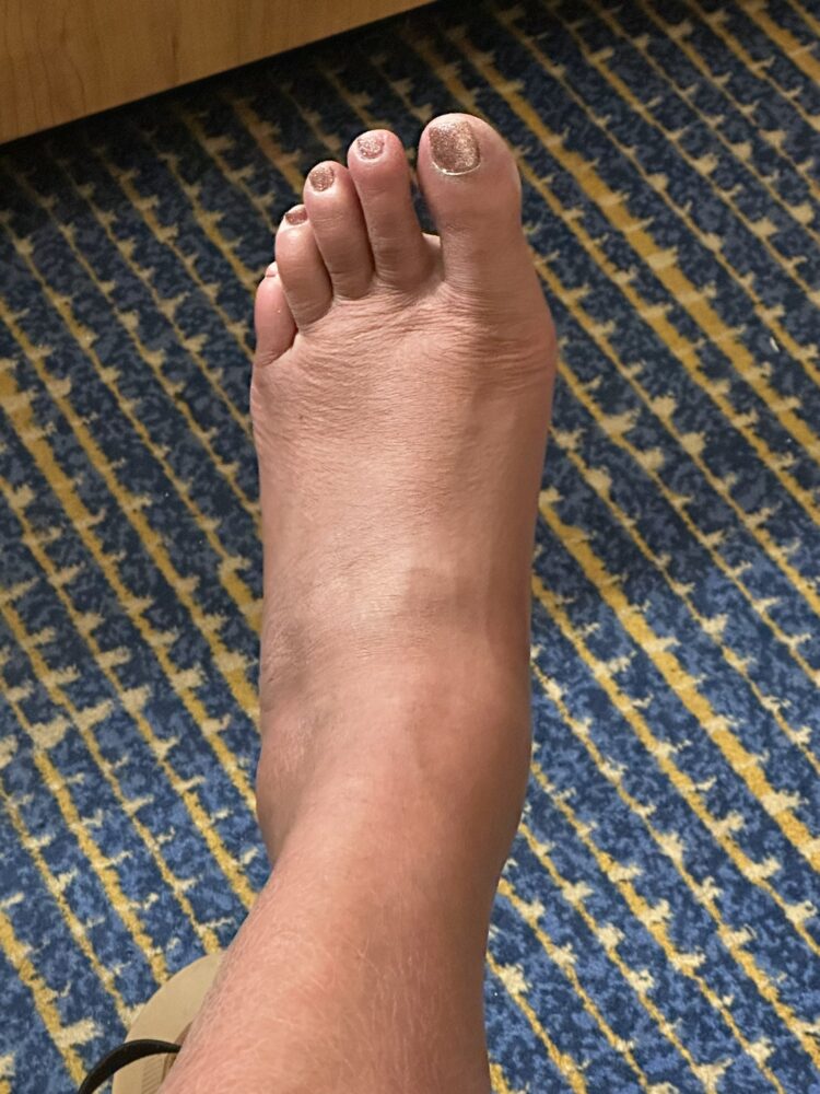 ufobri feet 5