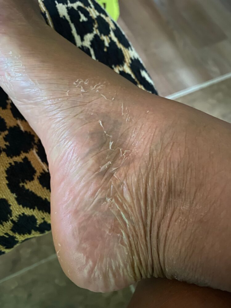 unoriginalrandomness feet 1