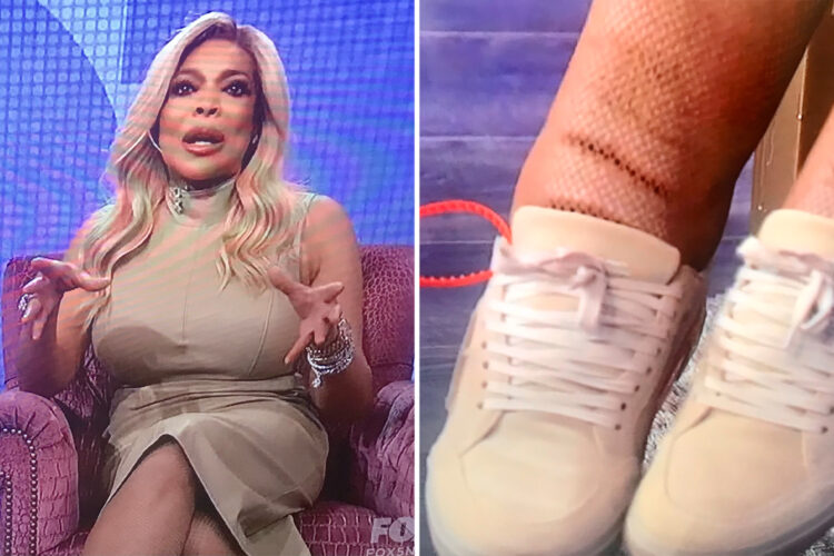 wendy williams feet 6